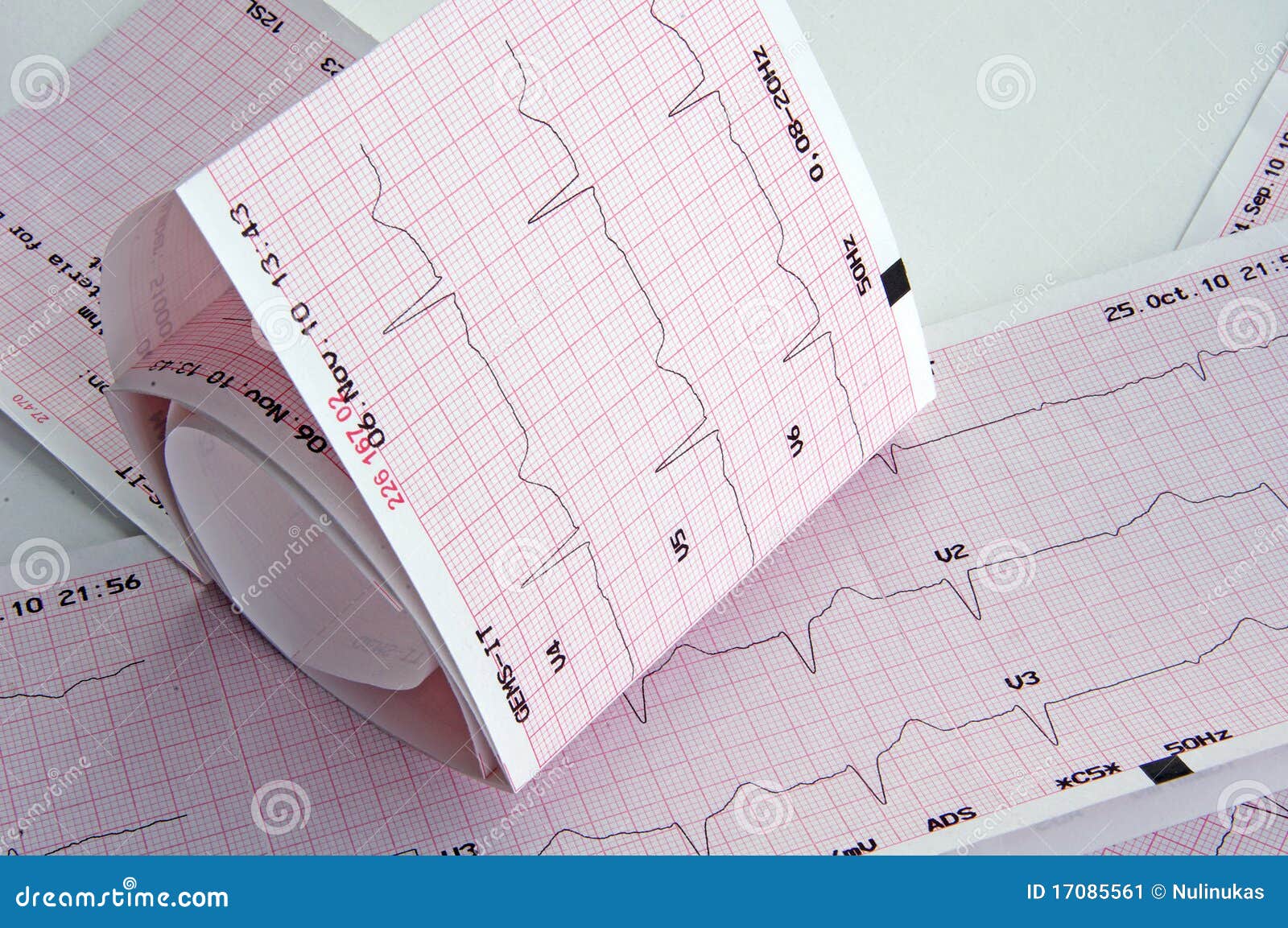 Tabell för cardiogramecggraf