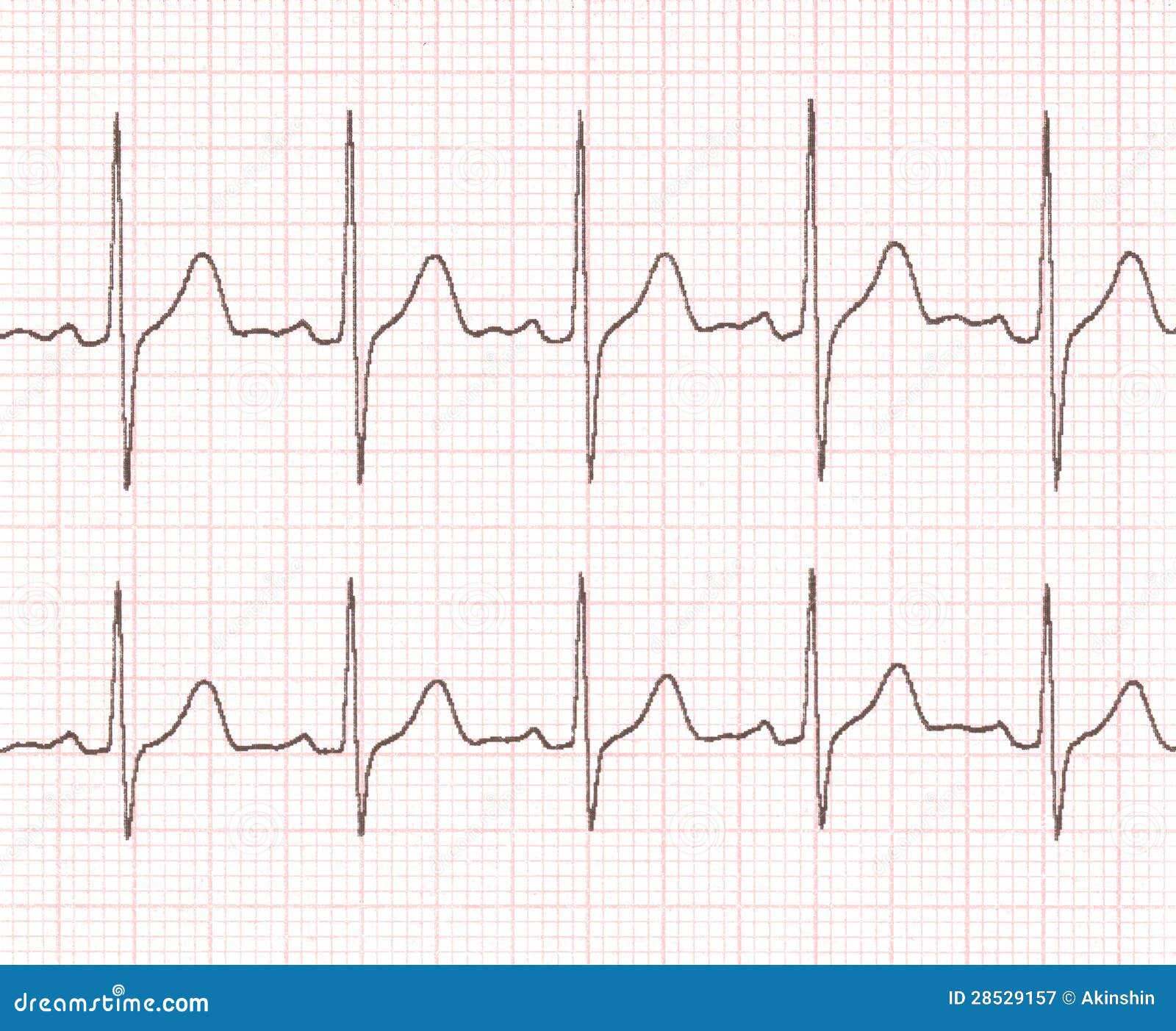 Cardiogram Royalty Free Stock Photography - Image: 28529157 ecg heart diagram 