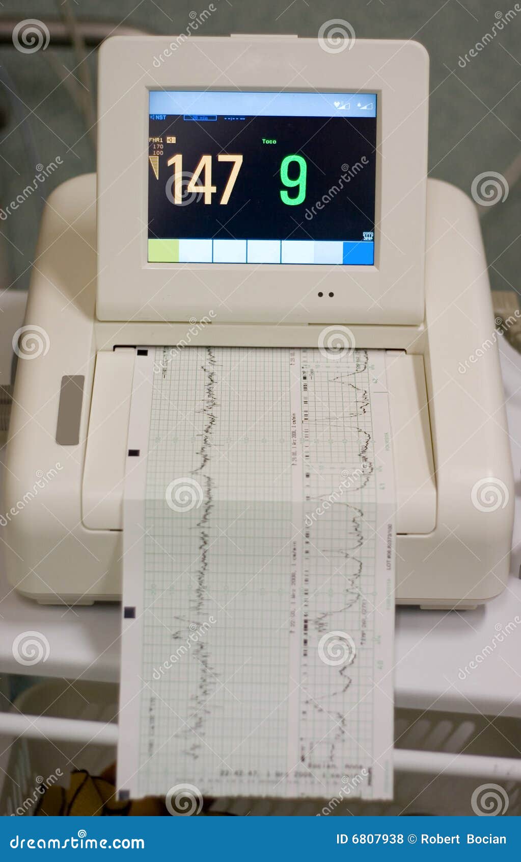 cardiograph corporation cardiograph corporation