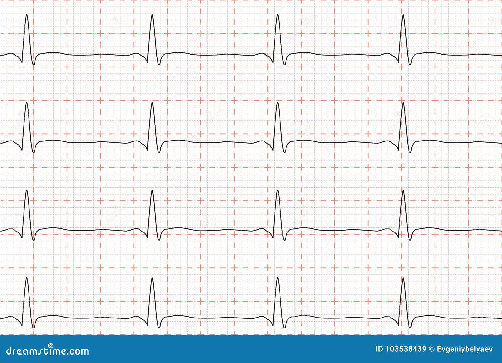 Ecg Chart