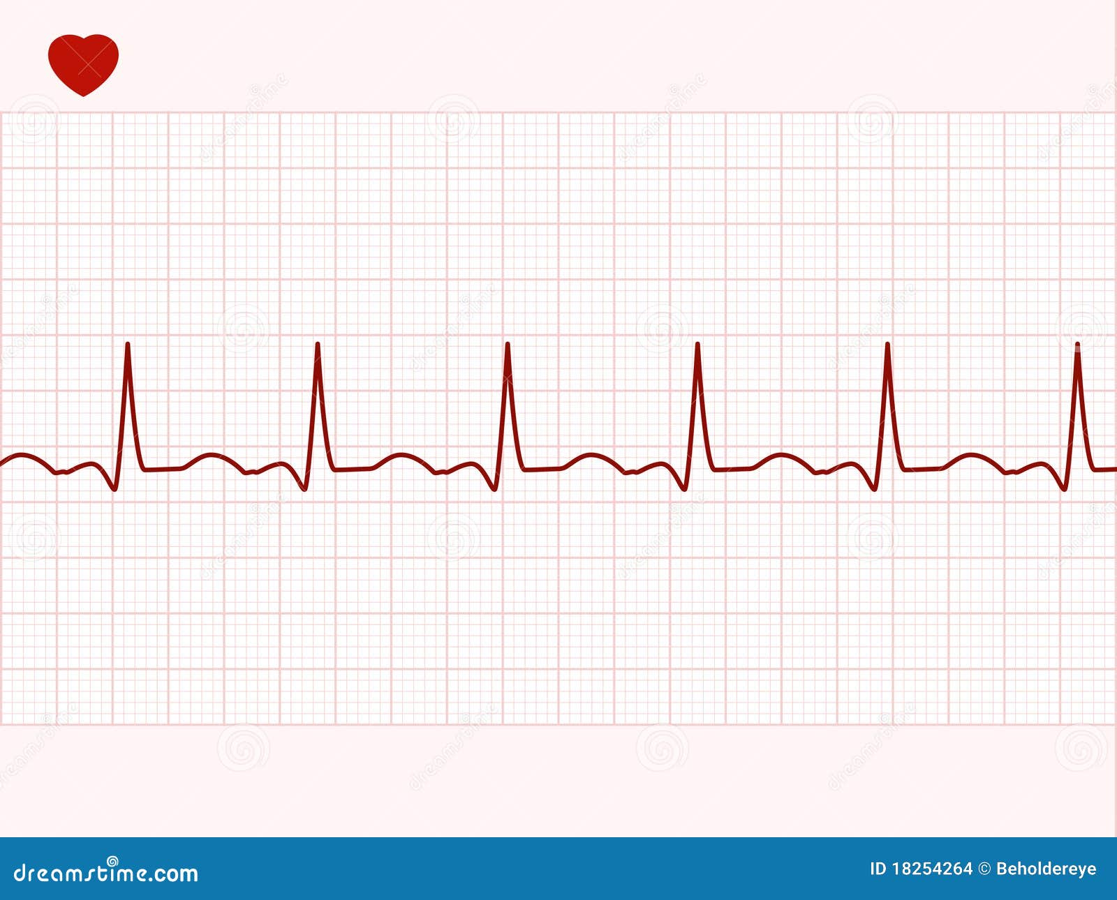 cardiograph bpm normal cardiograph bpm normal