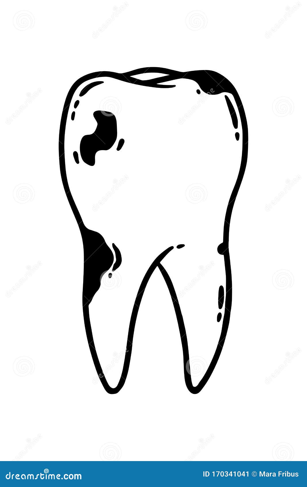 Caries Tooth Ilustración Vectorial De La Atención Odontológica Ilustración  del Vector - Ilustración de blanqueamiento, contorno: 170341041