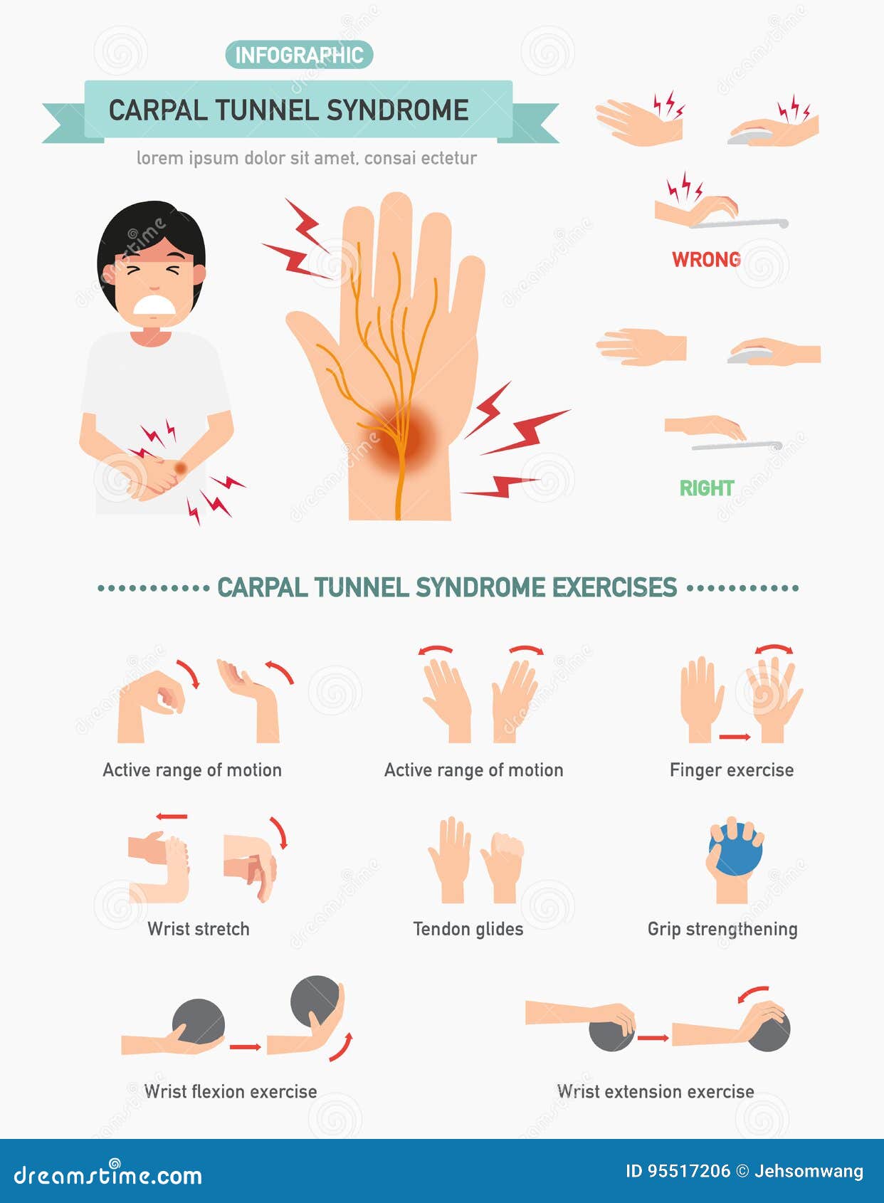 signs of carpal tunnel signs of carpal tunnel