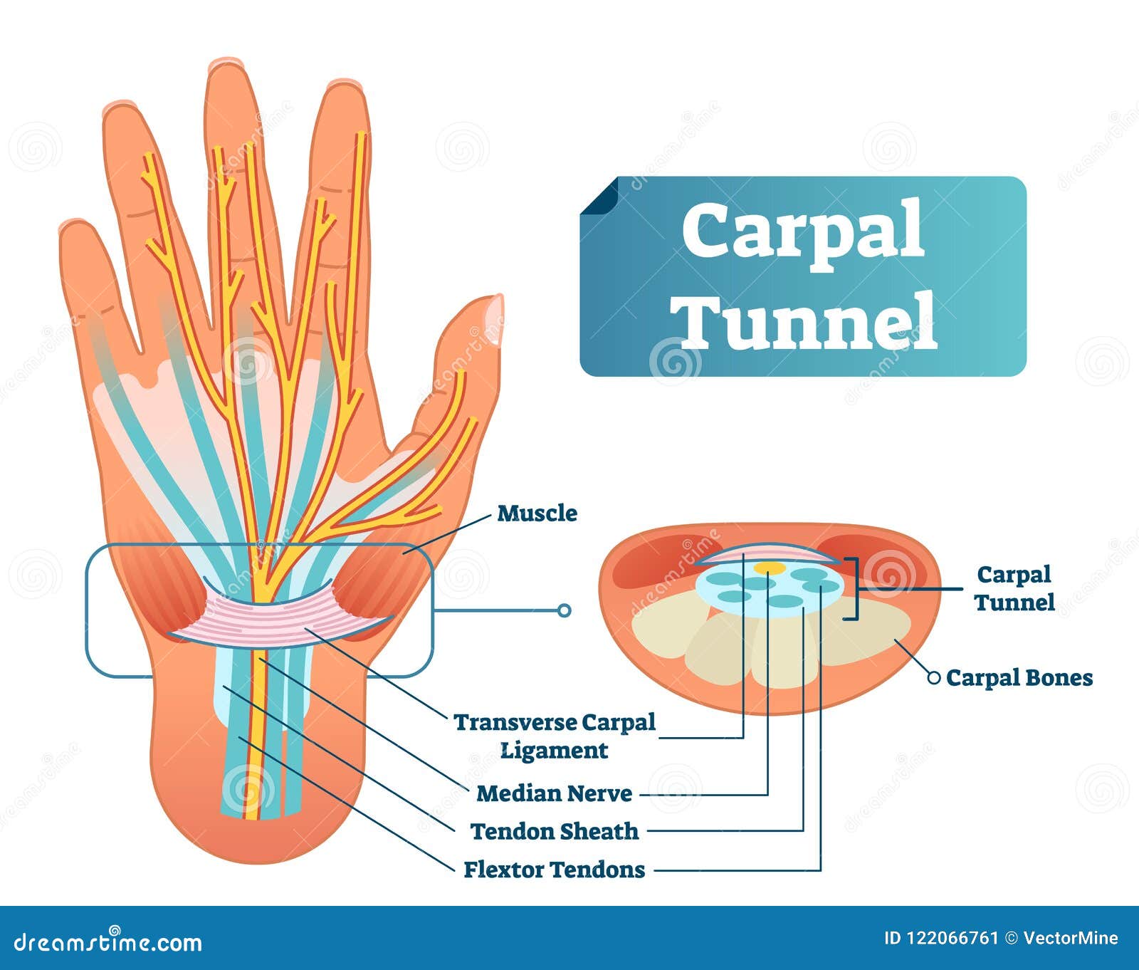 carpal tunnel   scheme. medical labeled diagram closeup with transverse carpal ligament and median nerve.