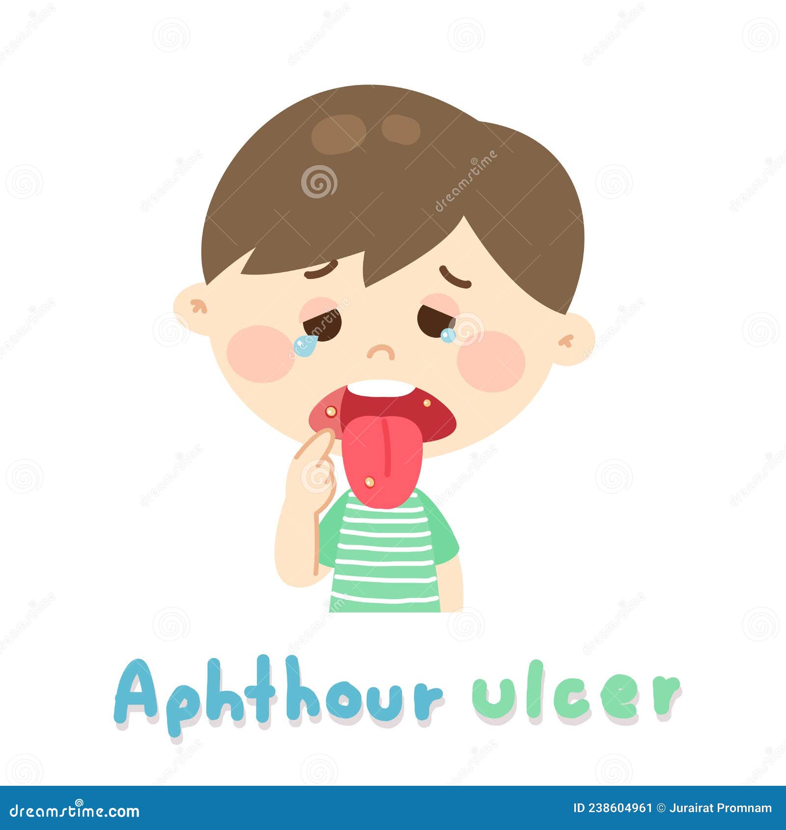 Cartoon Aphthous Ulcer On Background. 238604961