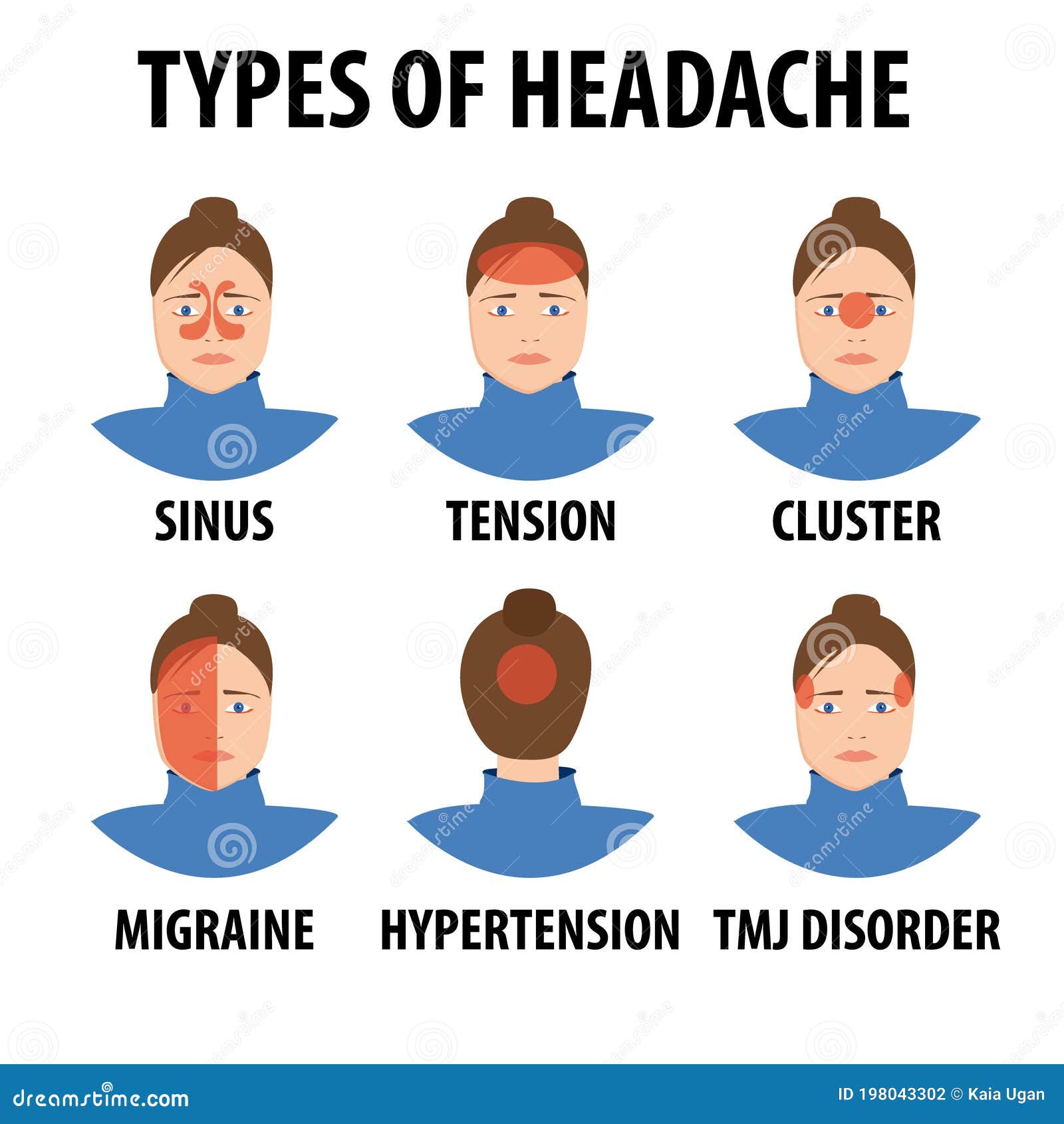 Cartoon Headache Types. Tension, Migraine, Sinus, Cluster, Allergy and ...