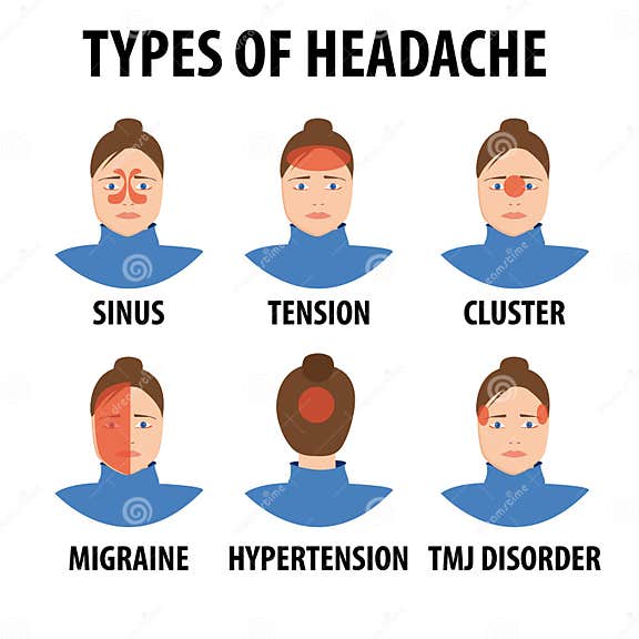 Cartoon Headache Types. Tension, Migraine, Sinus, Cluster, Allergy and ...