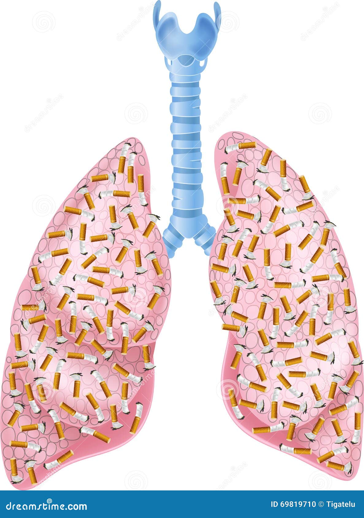Cartoon Illustration of Smokers Lungs Stock Vector Illustration of