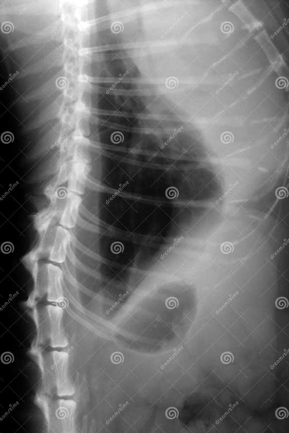 Cat Lungs XRay stock image. Image of diagnose, xray, radiation 3969567