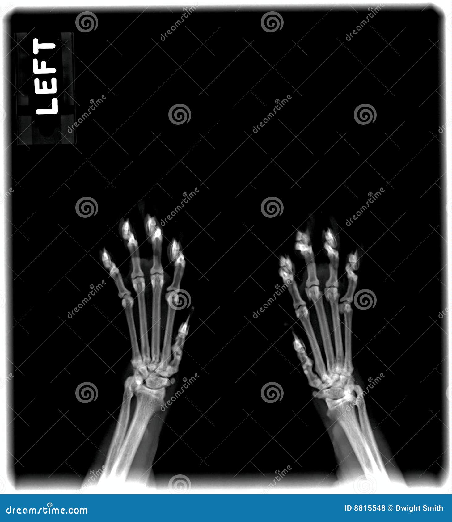 cat paw xray cat paw xray