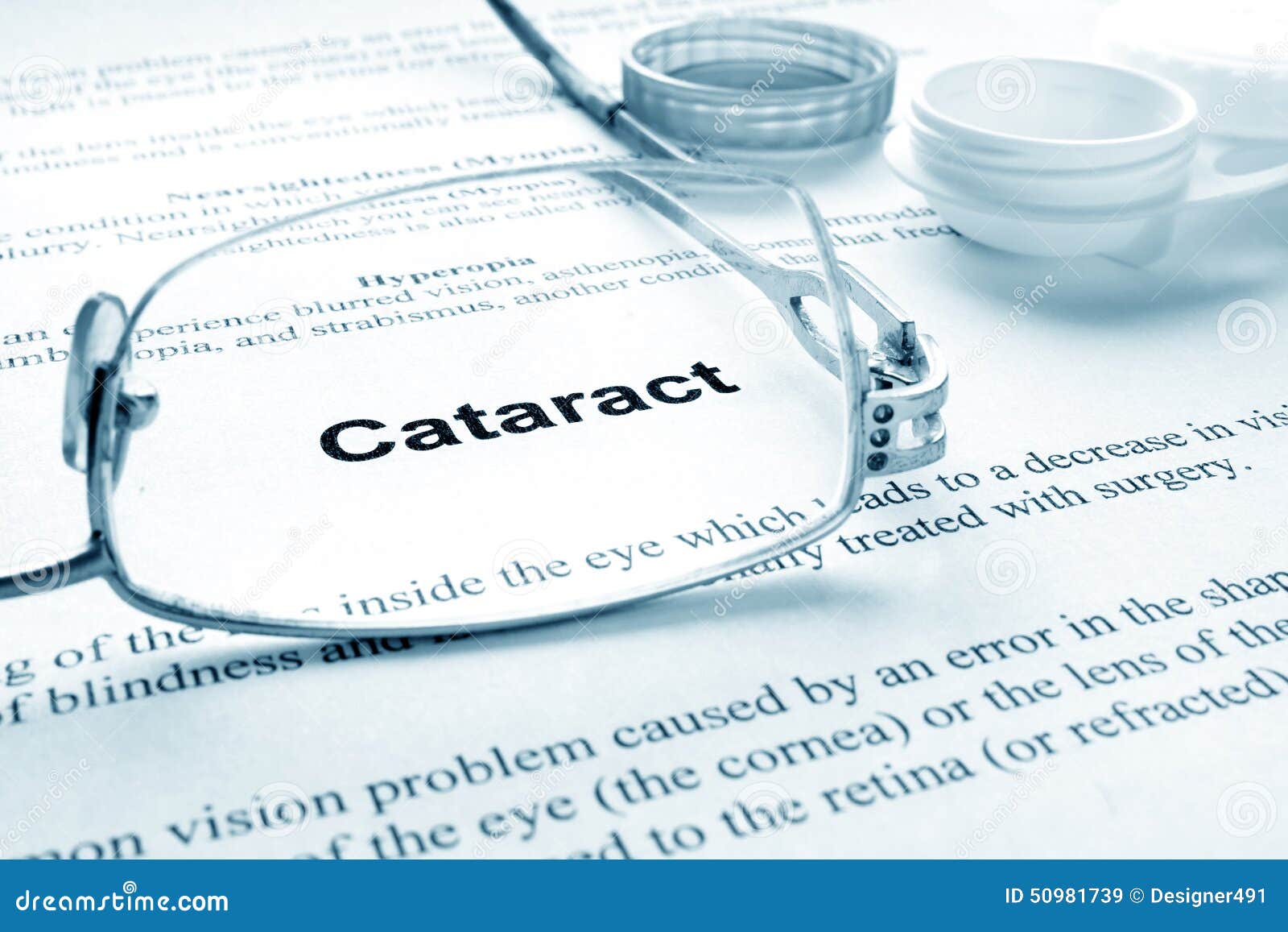 cataract