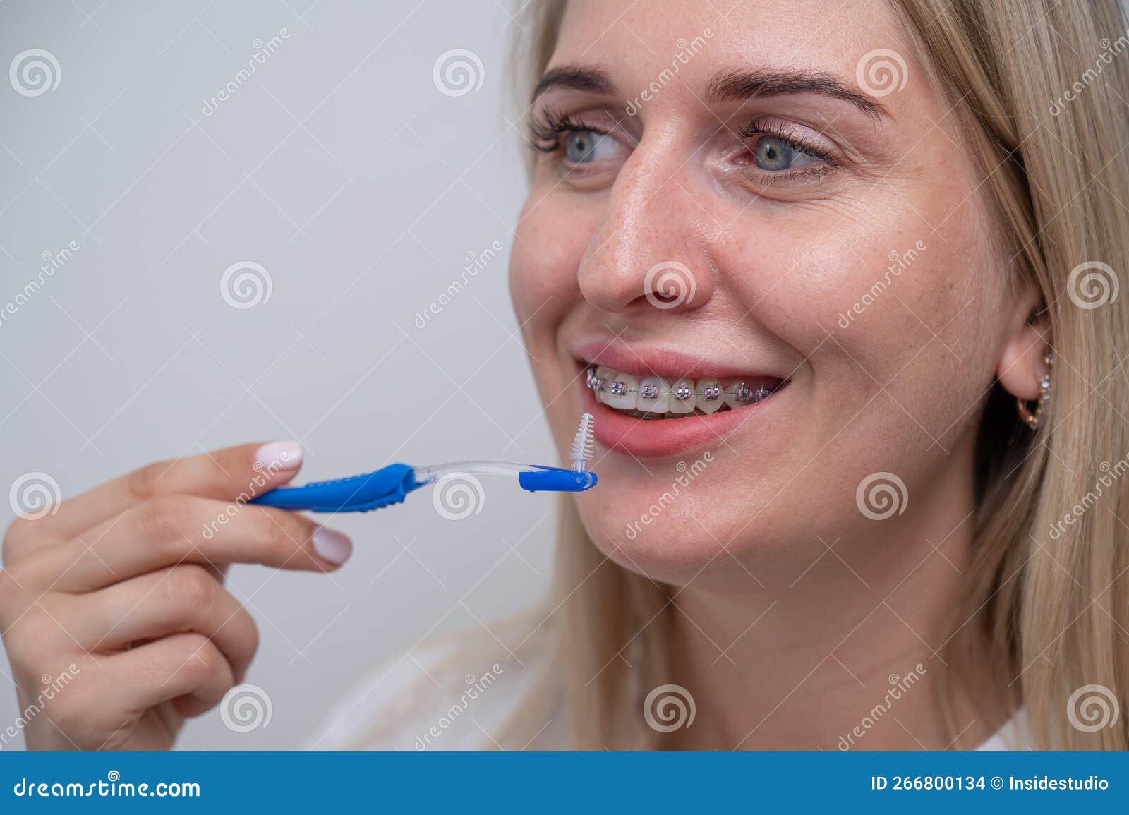 Caucasian Woman Cleaning Her Teeth with Braces Using a Brush. Stock