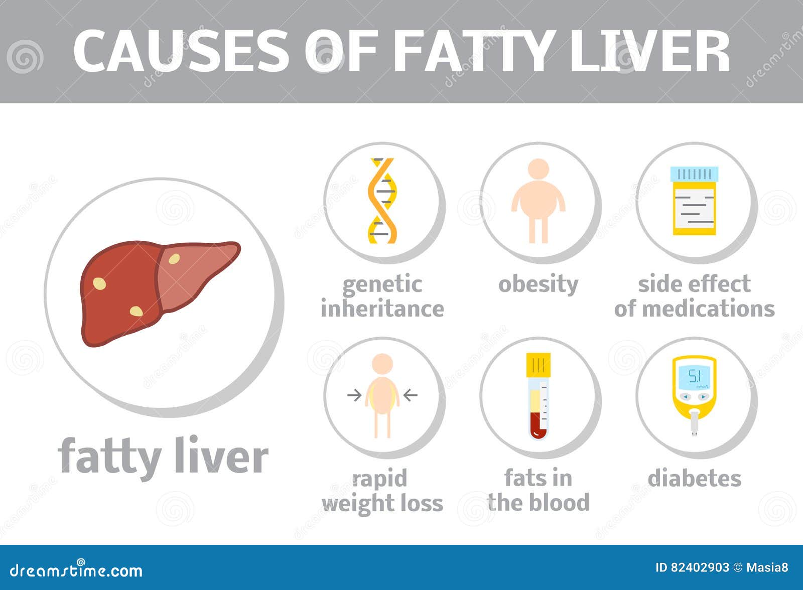 Cause Di Fegato Grasso Illustrazione Di Stock Illustrazione