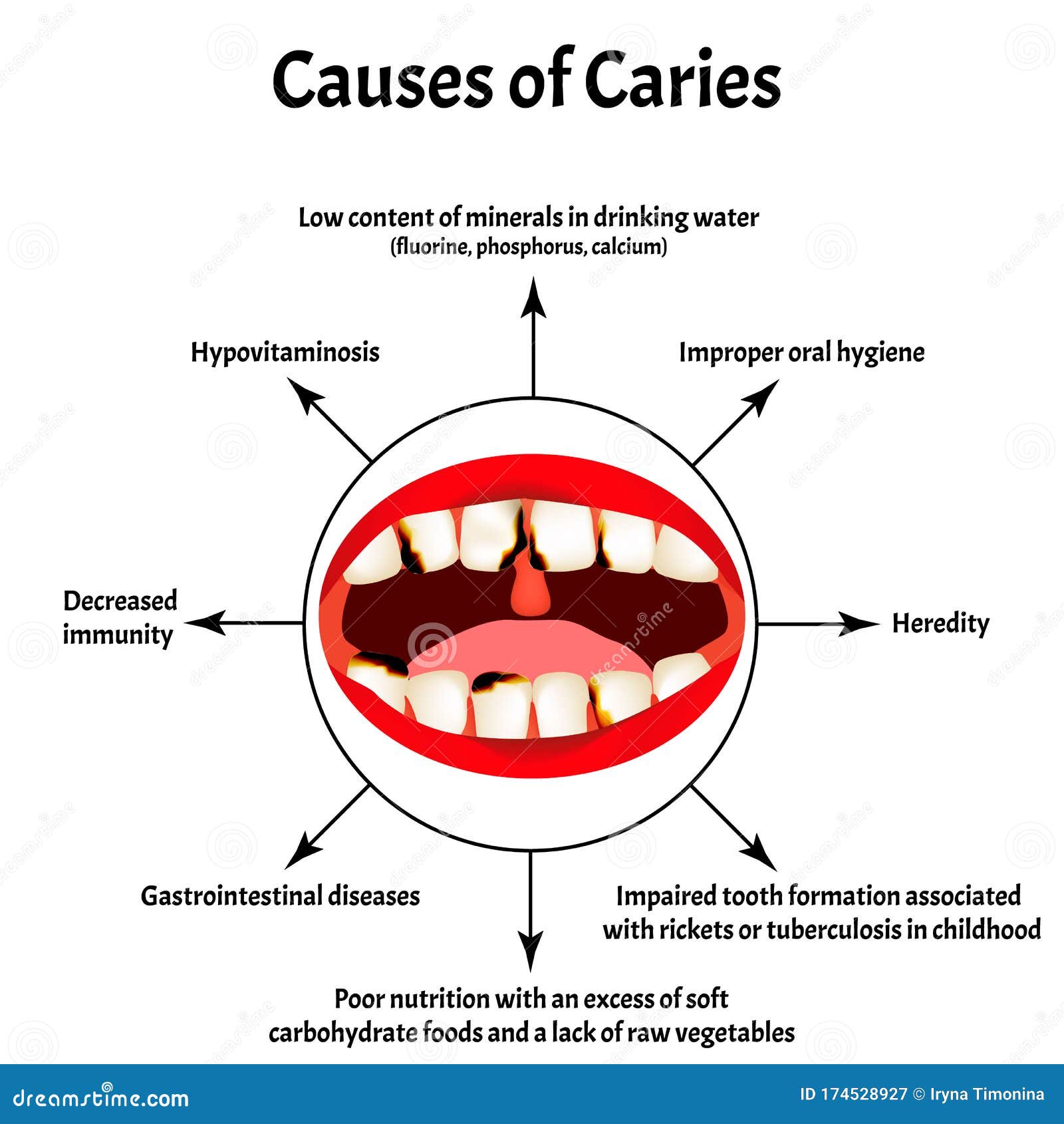 types of oral diseases