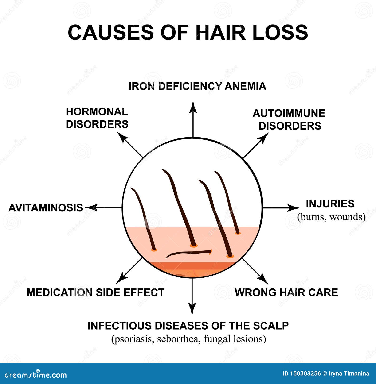 List 94+ Images hair diseases names with pictures Completed
