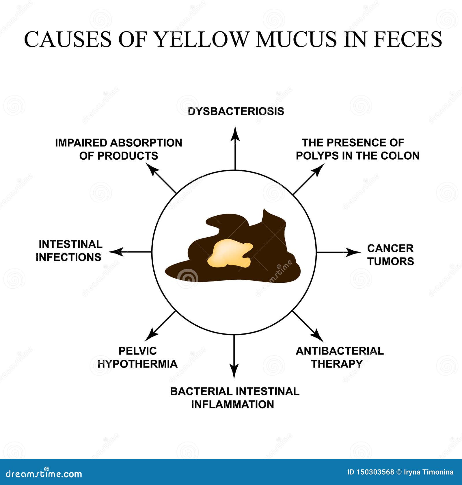 yellow mucus in stool