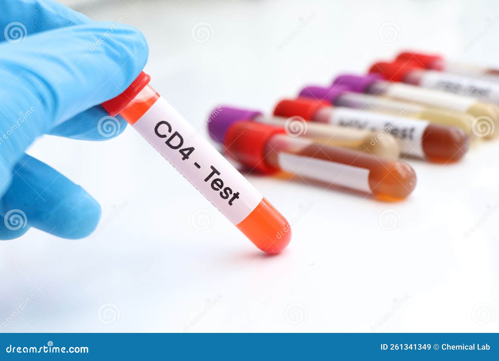 CD4 Test To Look for Abnormalities from Blood Stock Image Image of