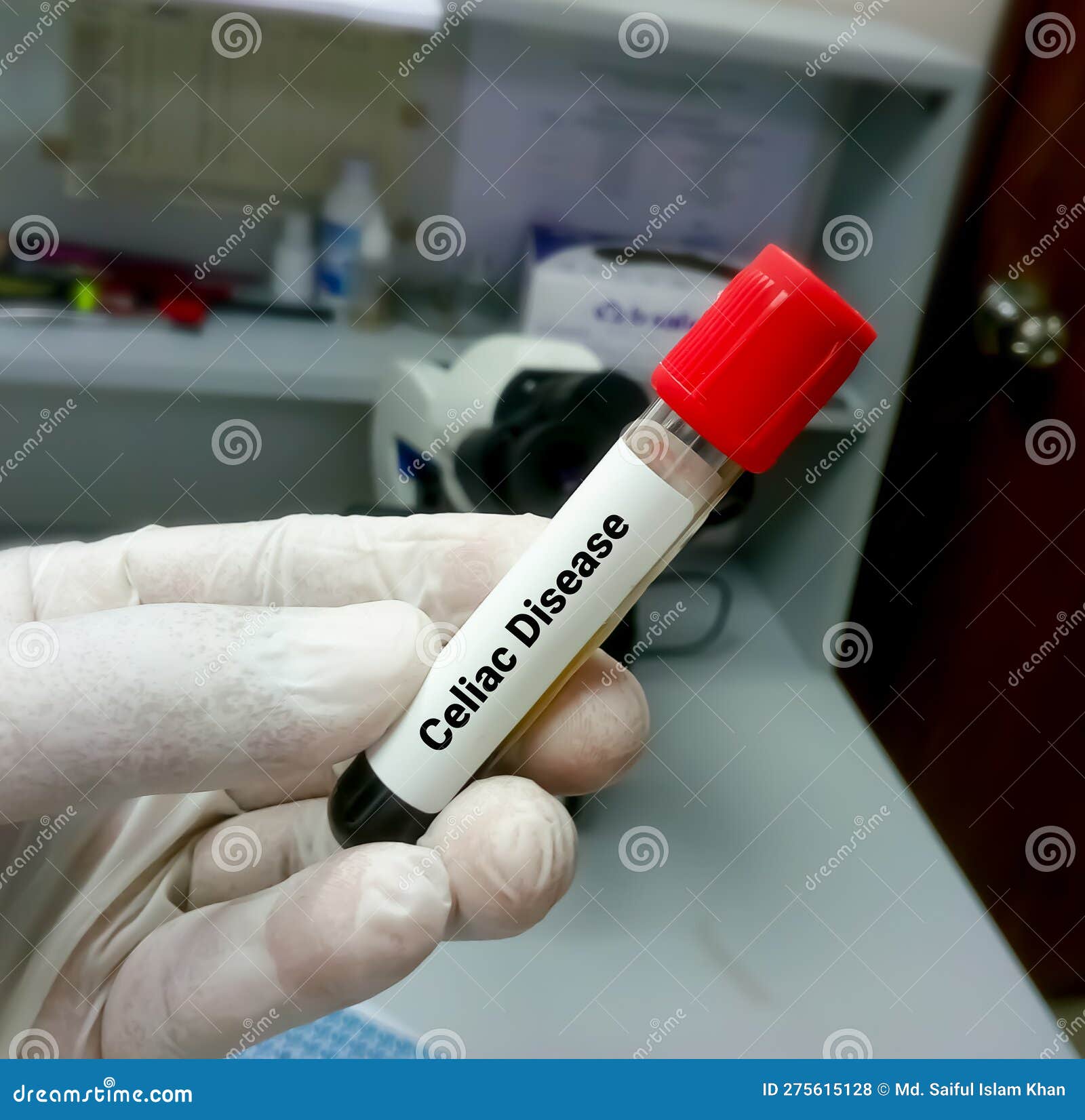 Celiac disease test stock photo. Image of celiac, intolerance 275615128