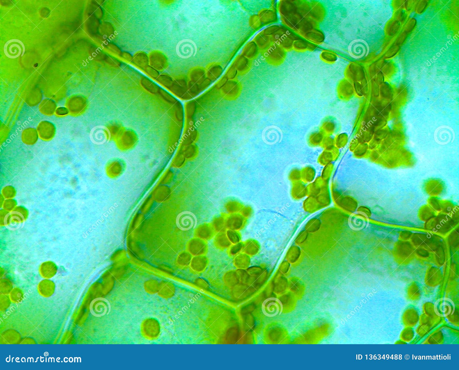 elodea water plant under microscope