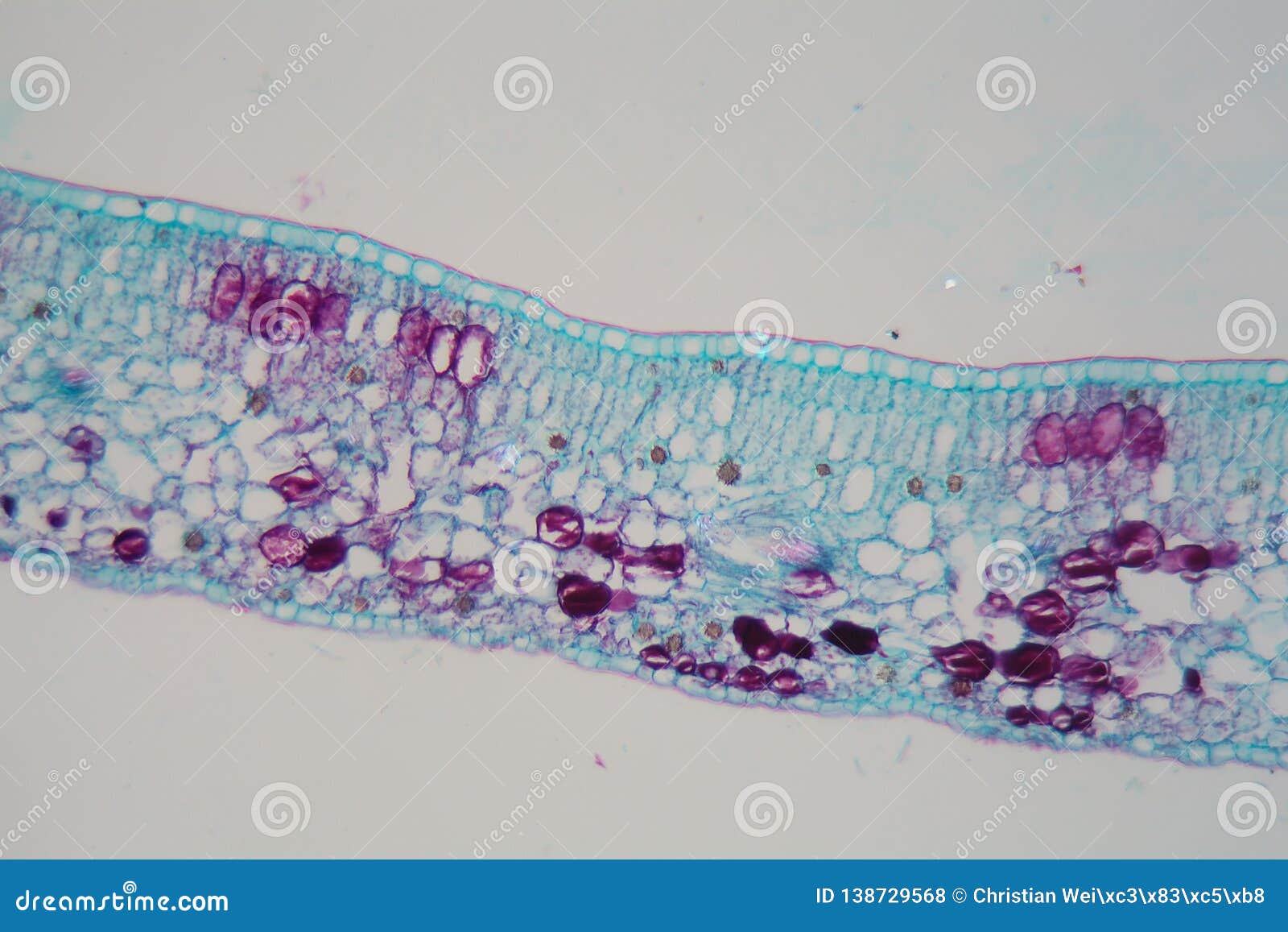 cells of a plant leaf with damaged epidermis and chloroplasts under a microscope