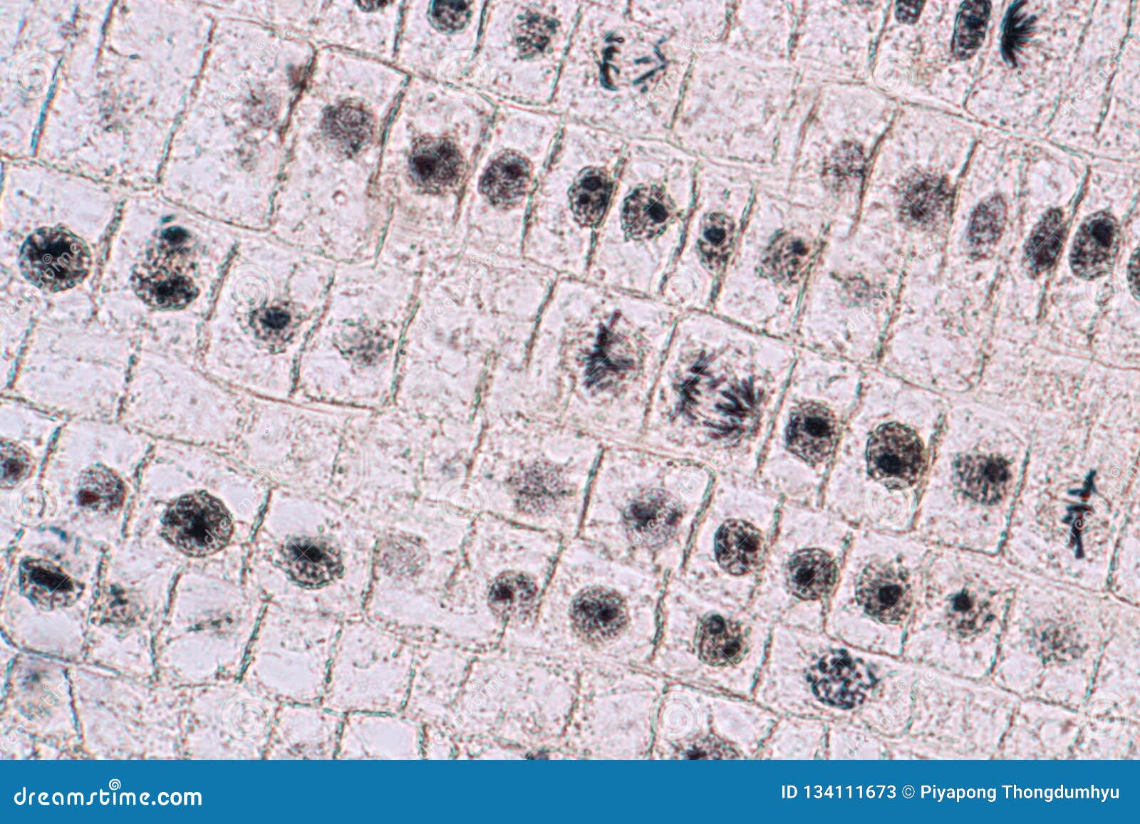 Cellule De Mitose Dans L Astuce De Racine De L Oignon Sous Un Microscope Image Stock Image Du Nucleolus Death