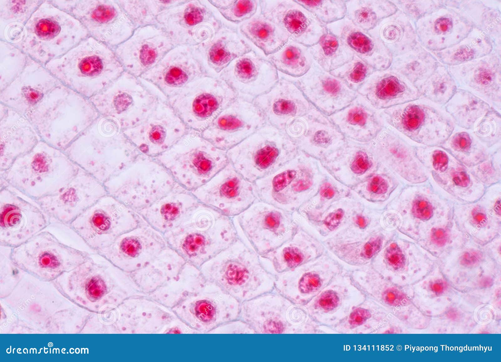 Cellule De Mitose Dans L Astuce De Racine De L Oignon Sous Un Microscope Photo Stock Image Du Histologie Laboratoire