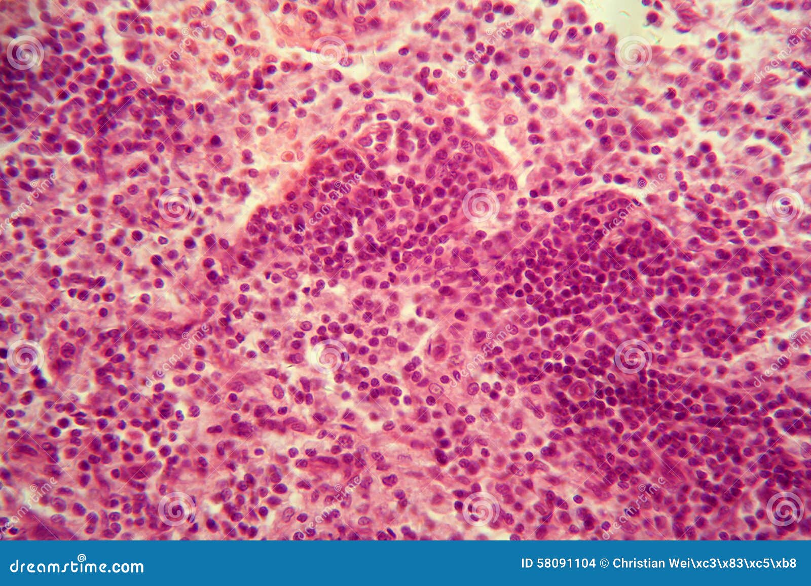 Clinic tear down folder Cellules De Ganglion Lymphatique Sous Le Microscope Photo stock - Image du  microscope, laboratoire: 58091104