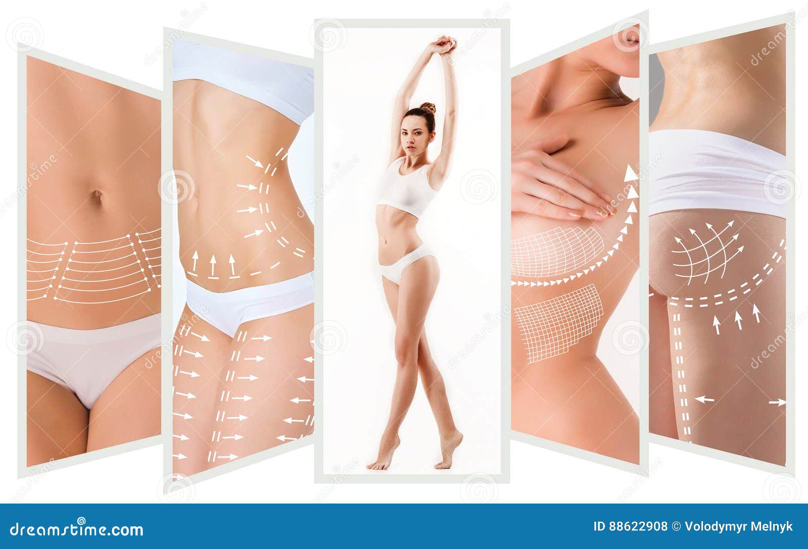 the cellulite removal plan. white markings on young woman body