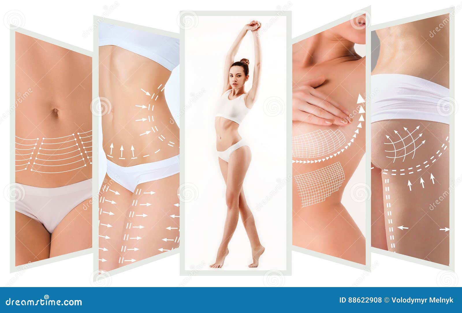 Woman grabbing skin on her flanks with the black color crosses marking,  Lose weight and liposuction cellulite removal concept, Isolated on white  backg Stock Photo - Alamy