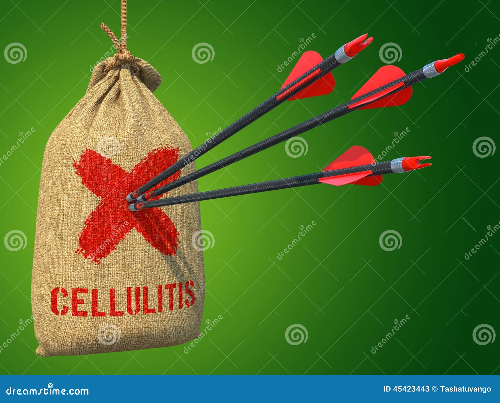 cellulitis - arrows hit in red target.