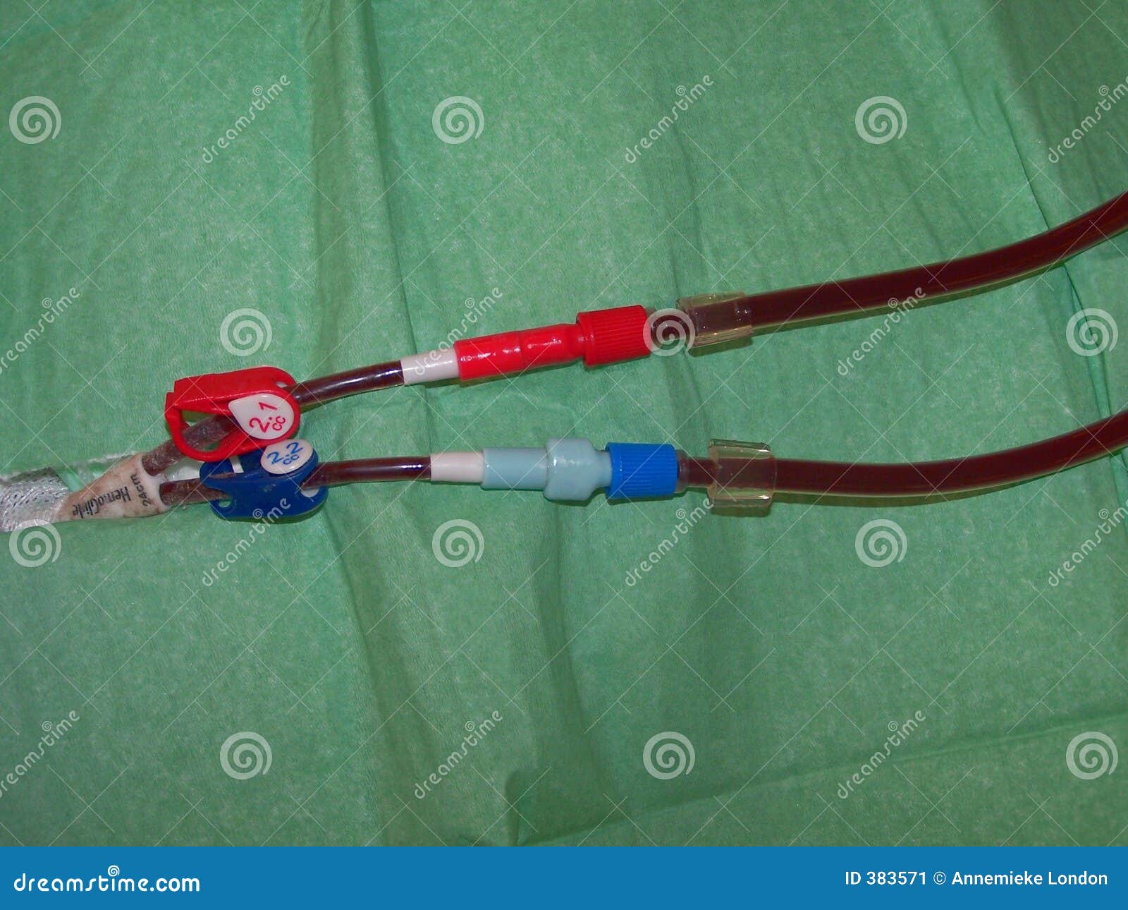 Central Venous Dialysis Catheter Closeup Stock Image Image of venous