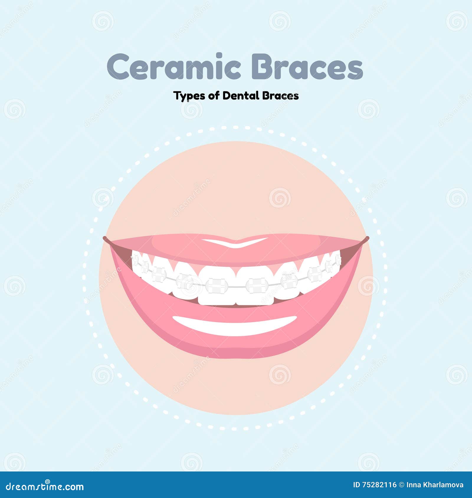 Braces Smile Stock Illustrations – 6,183 Braces Smile Stock Illustrations, Vectors & Clipart - Dreamstime Braces Smile Stock Illustrations – 6,183 Braces Smile Stock Illustrations, Vectors & Clipart - Dreamstime