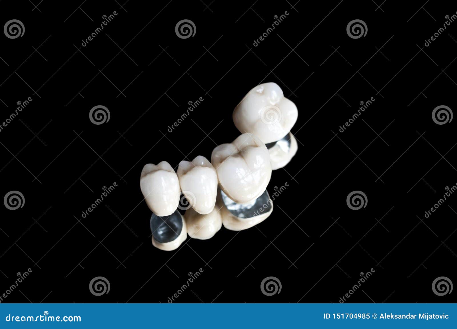 ceramic dental crowns