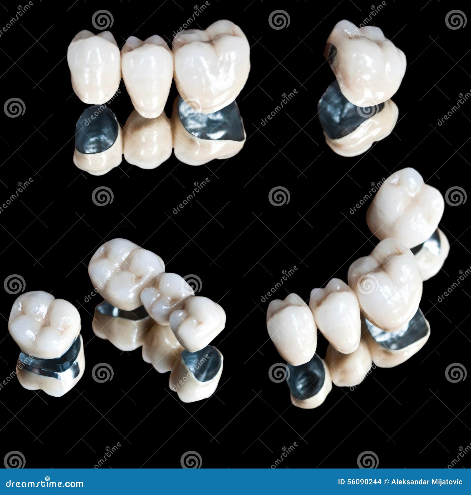 Ceramic teeth set stock photo. Image of macro, cervical 56090244