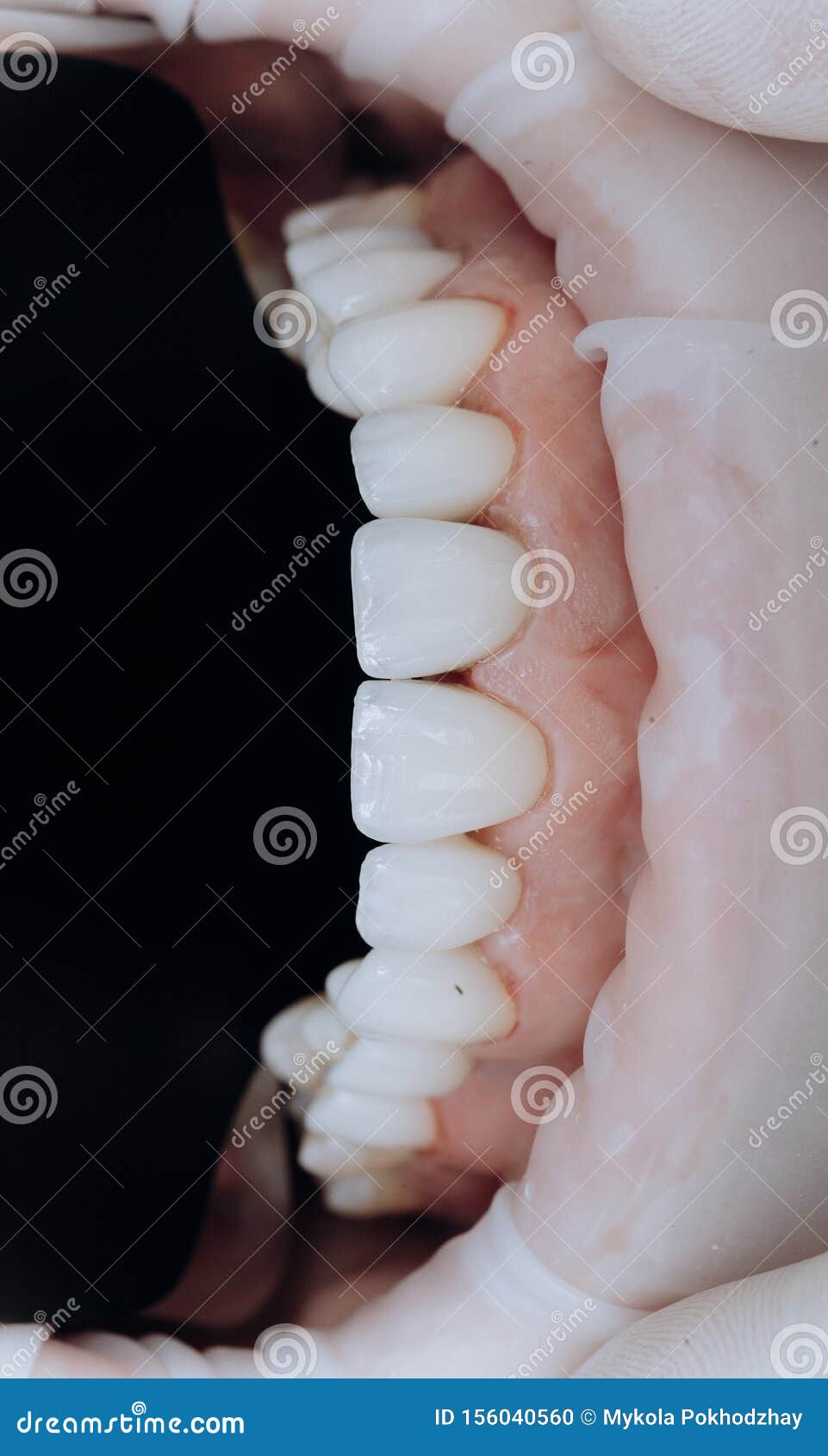 Ceramic Zirconium in Final Version. Precision Design and High Quality Materials Stock Photo