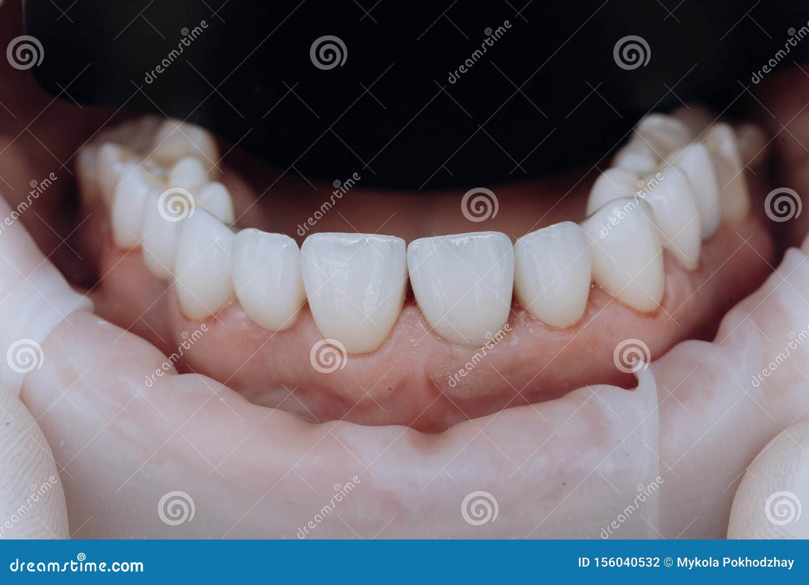 Ceramic Zirconium in Final Version. Staining and Glazing. Precision Design and High Quality