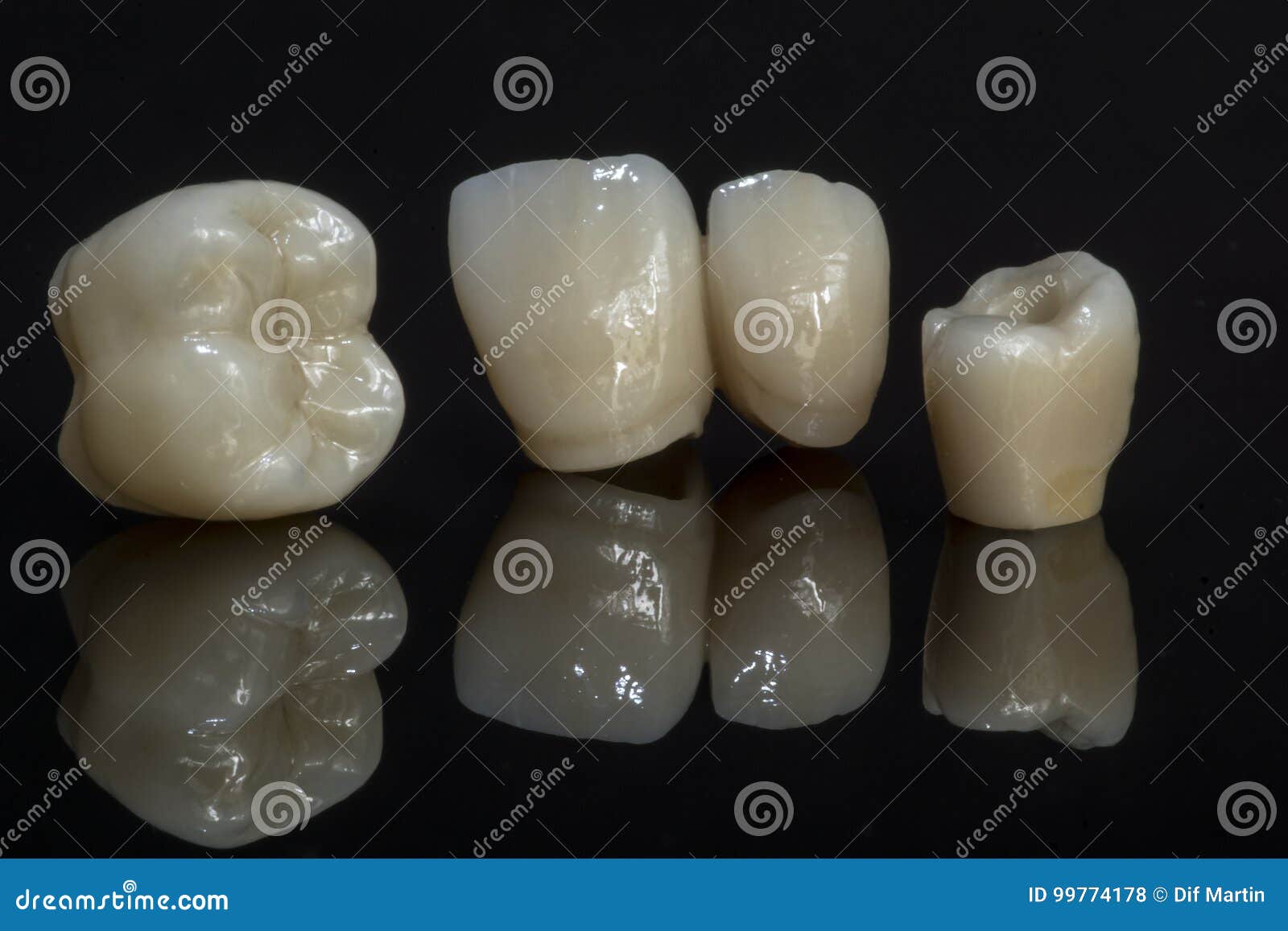 Ceramic Zirconium. Teeth. Dental Technician. Stock Photo Image of