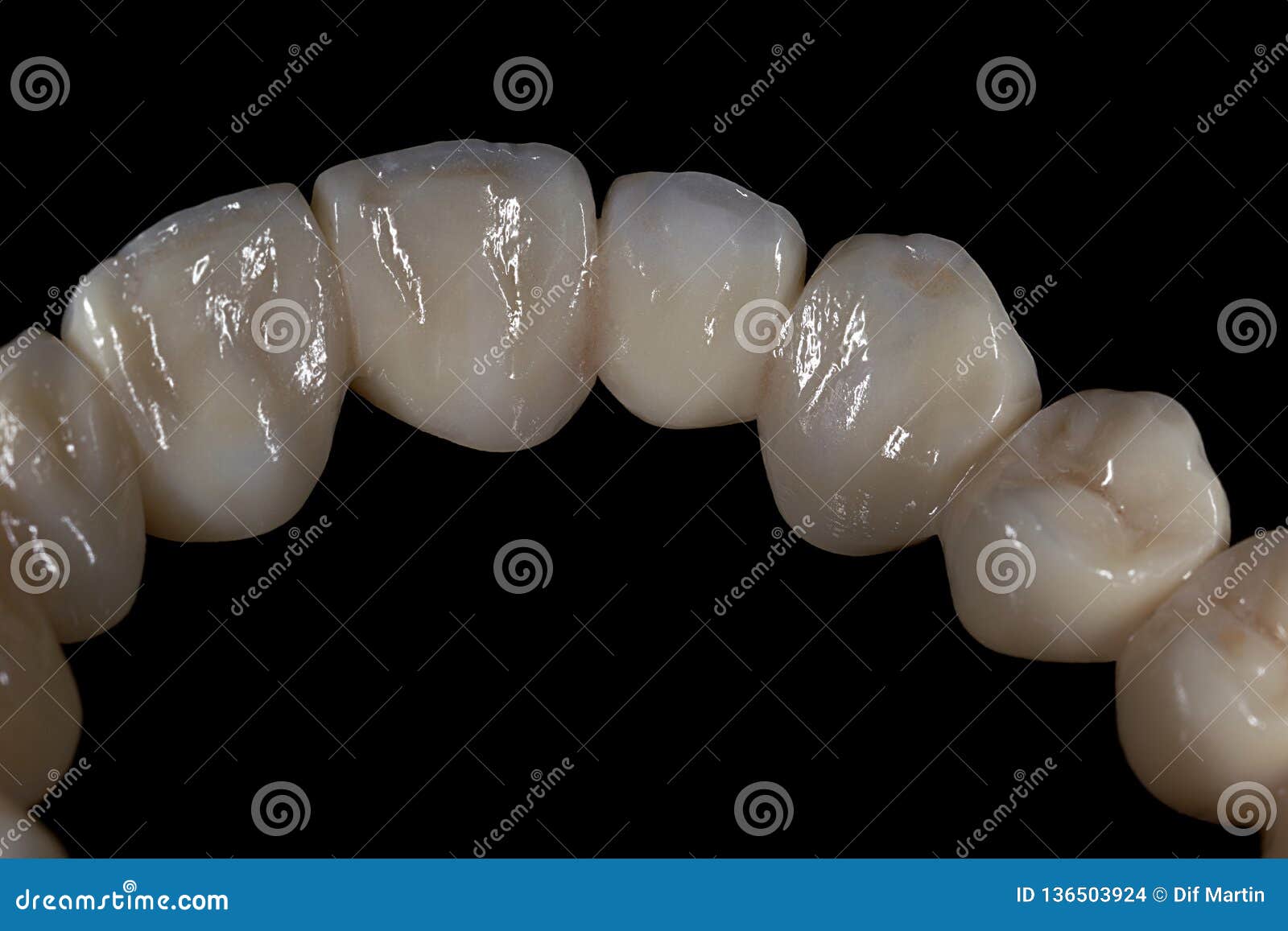 Ceramic Zirconium. Teeth. Dental Technician. Stock Photo Image of smile, laboratory 136503924