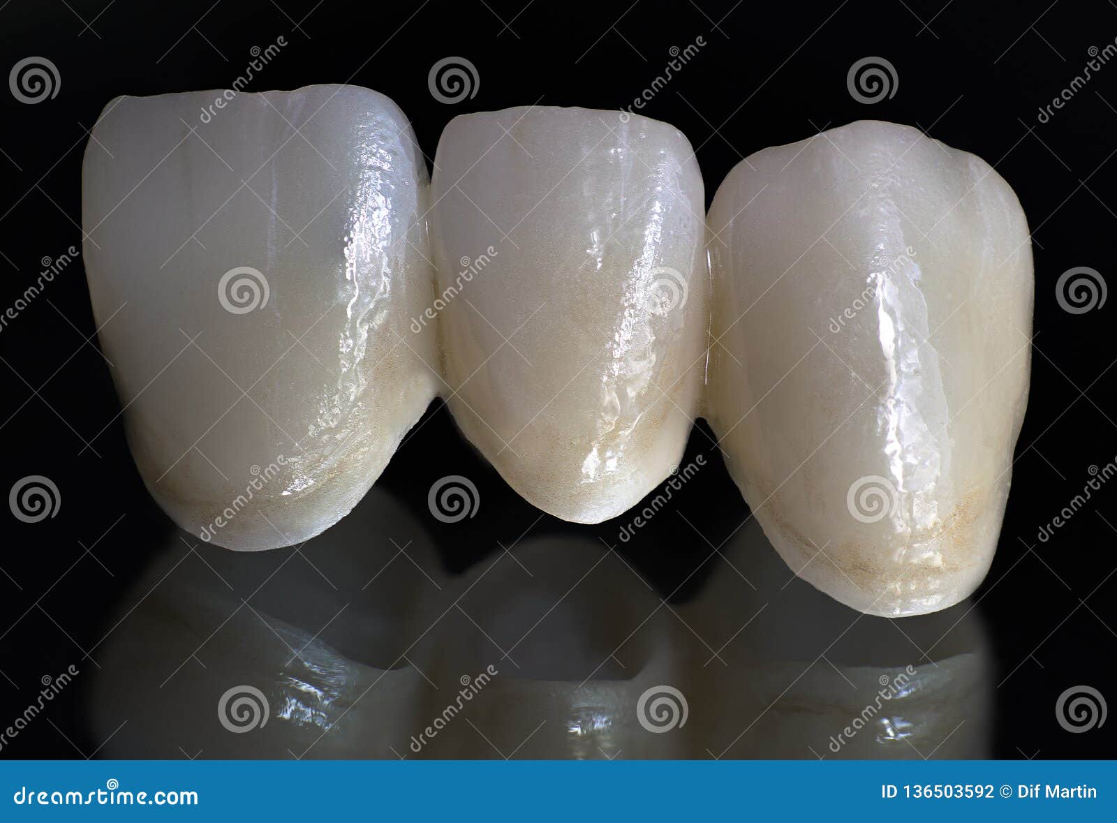 Ceramic Zirconium. Teeth. Dental Technician. Stock Photo Image of