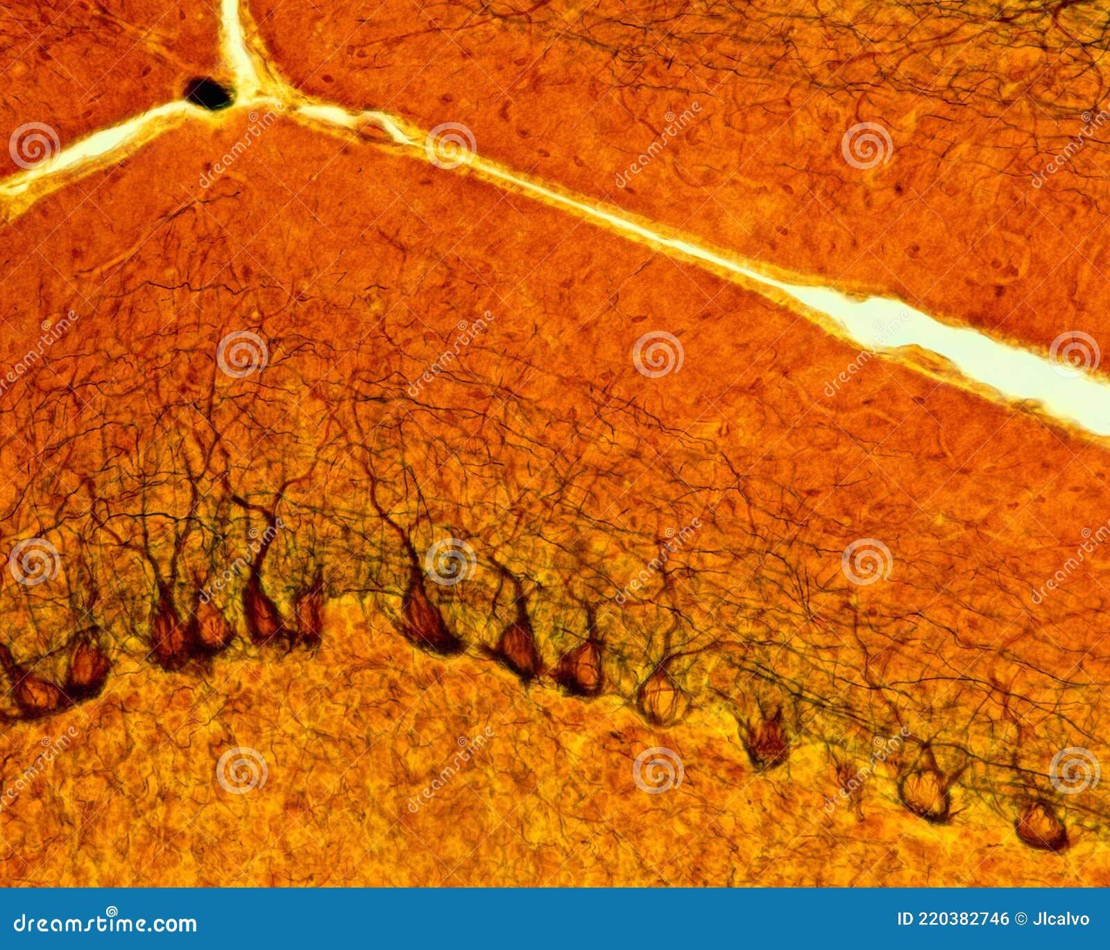 cerebellum. purkinje cells