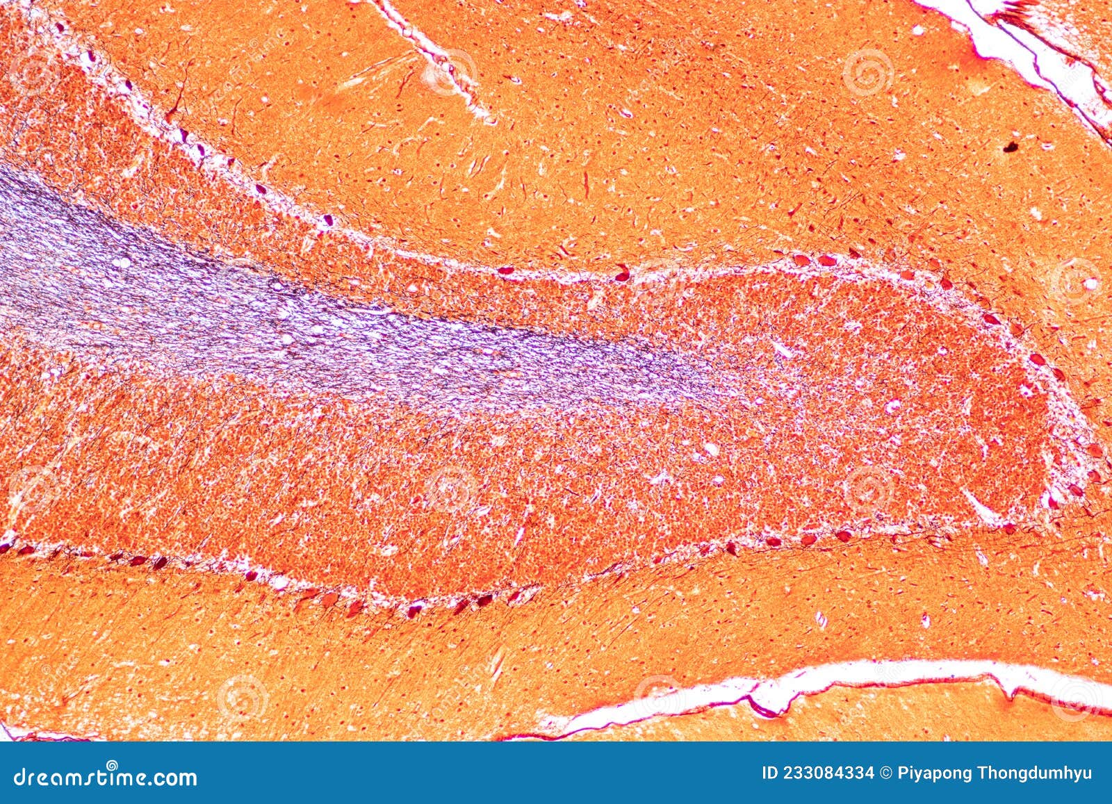 cerebellum, thalamus, medulla oblongata, spinal cord and motor neuron human under the microscope.
