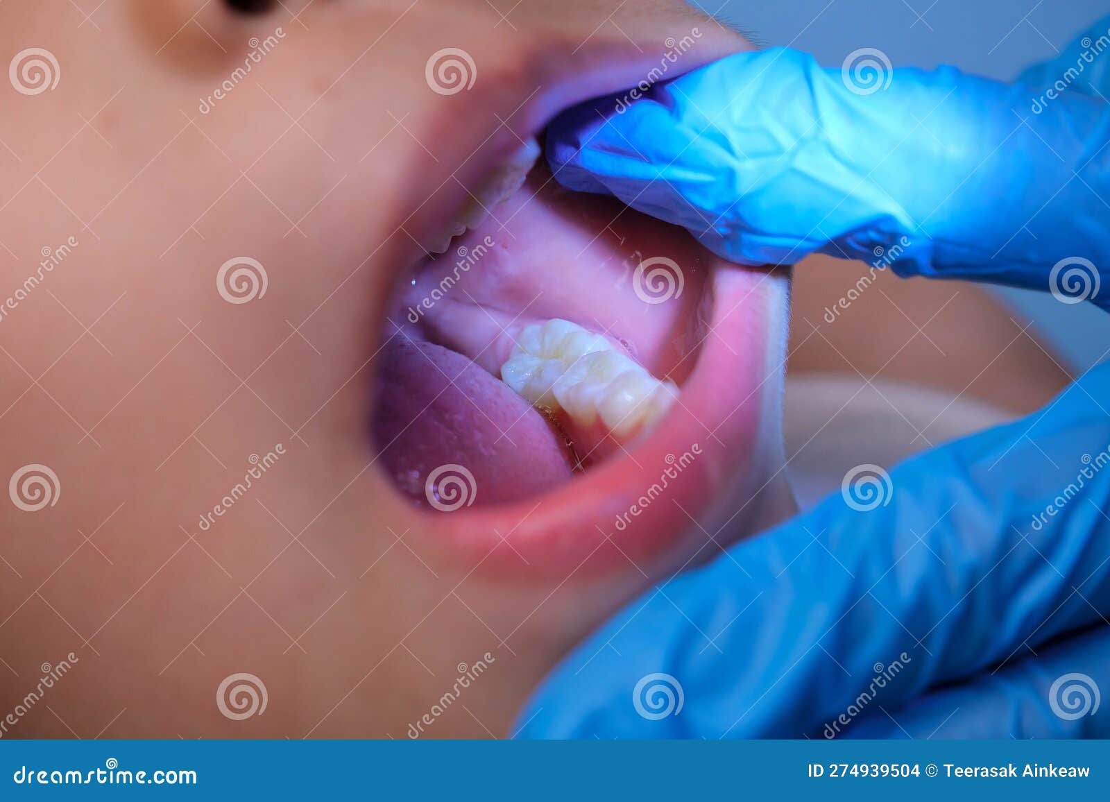 Niño Sonríe Con La Boca Cerrada Cerrando El Cierre De Un Concepto De Boca  De Niño Cuidado De La Piel De Niño Desarrollo Emocional Foto de archivo -  Imagen de oral, felicidad