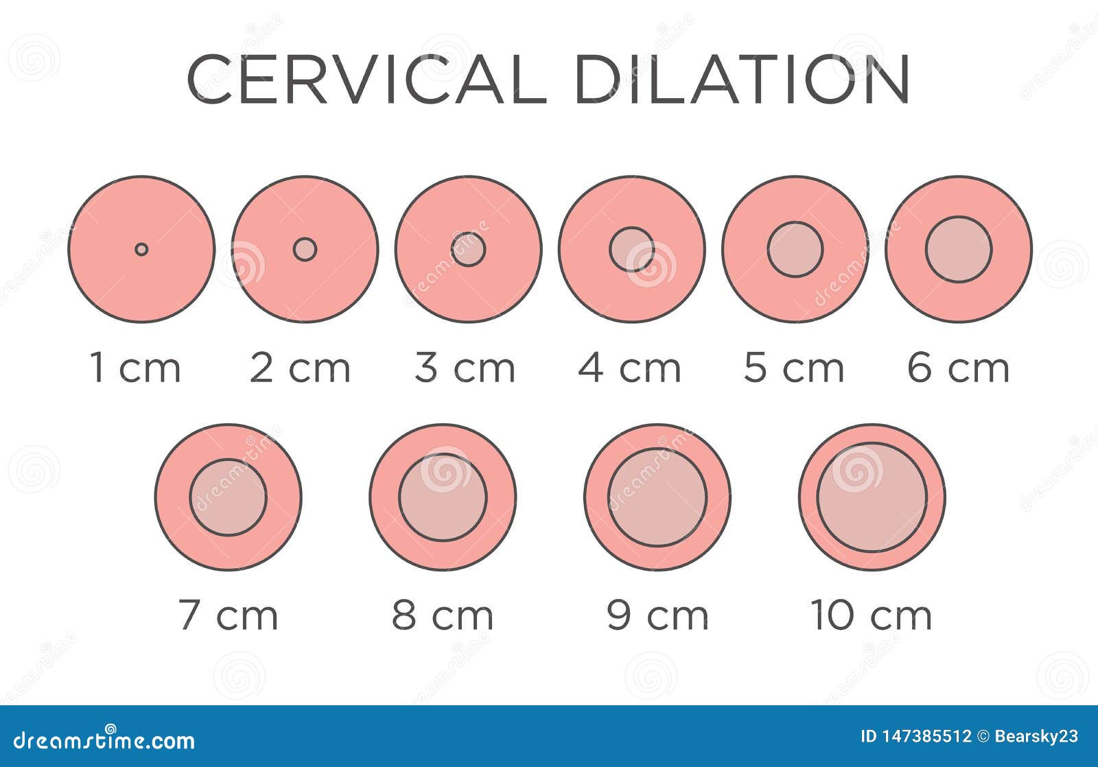 Dilation For Birth Chart