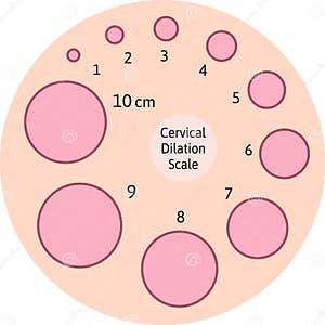 Cervical Dilation Cervix Dilation Chart Cervical Dilation Chart Images And Photos Finder