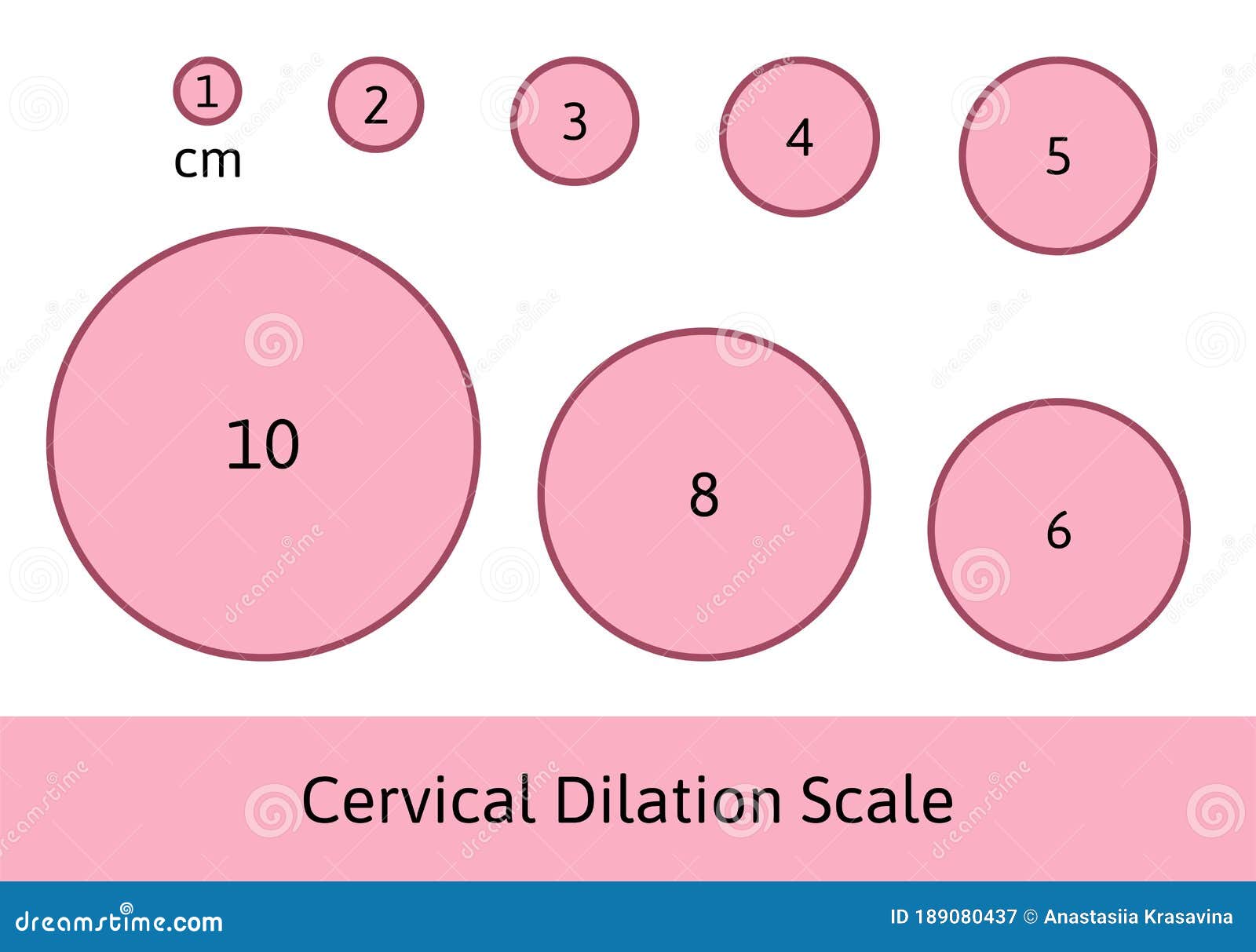Cervical Dilation Chart Printable