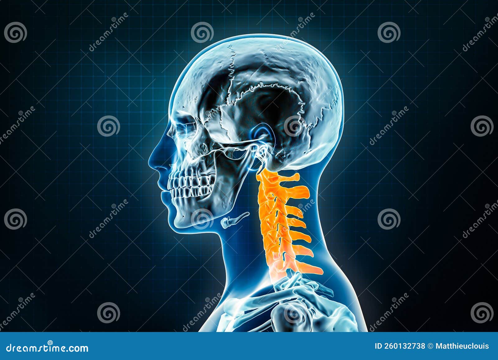 Cervical Vertebrae X-ray Lateral or Profile View. Osteology of the ...