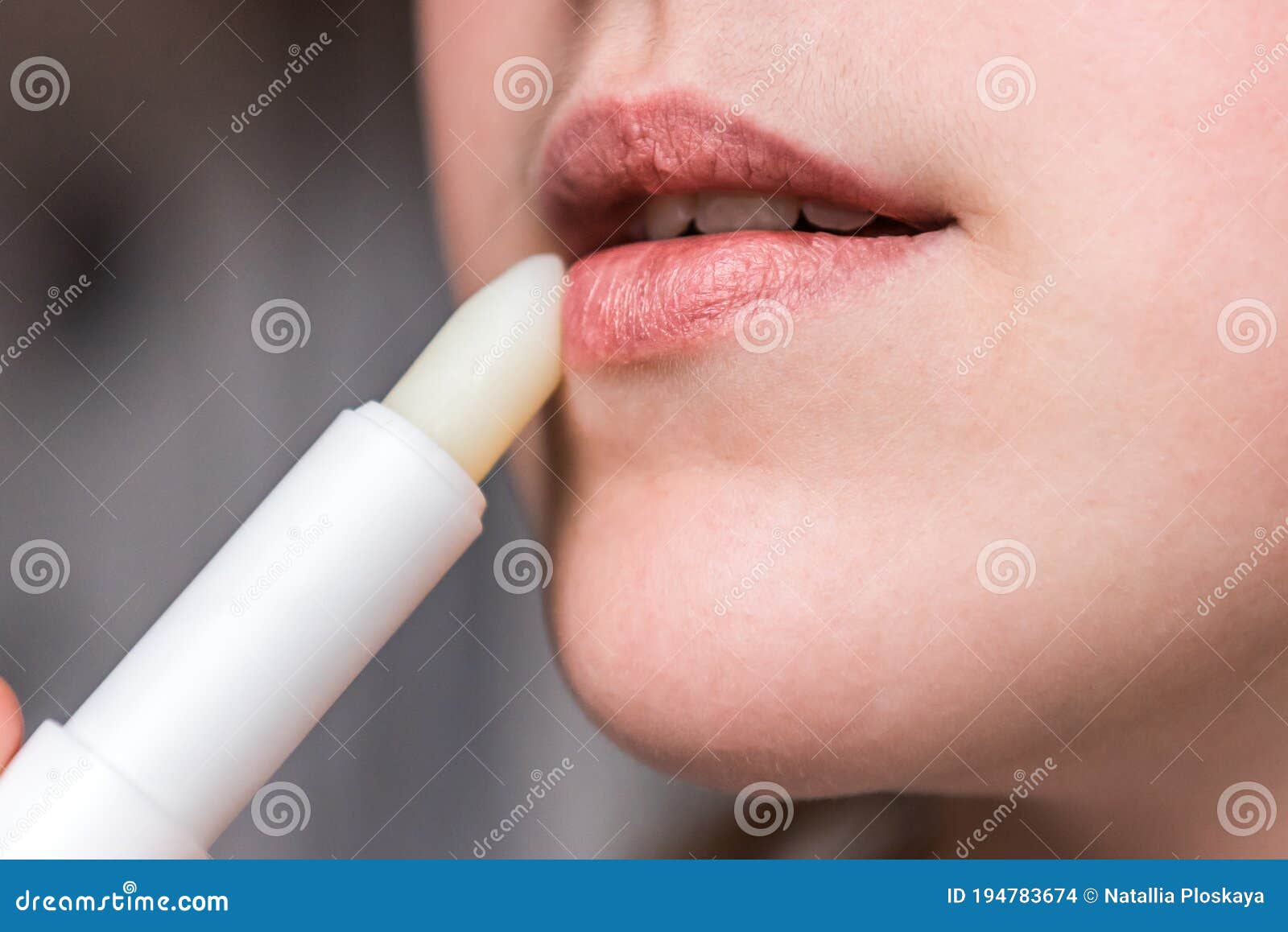 chapped, or cracked, dry lips that have lost moisture. woman maintains her lips. lip care