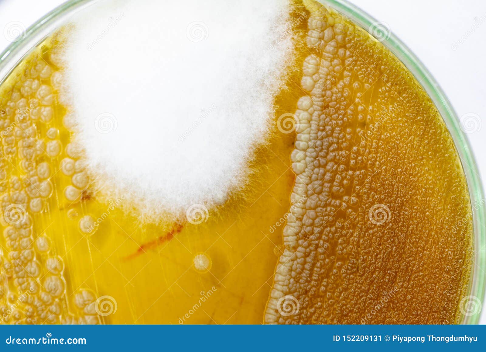 Characteristics and Different Shaped Colony of Bacteria and Mold