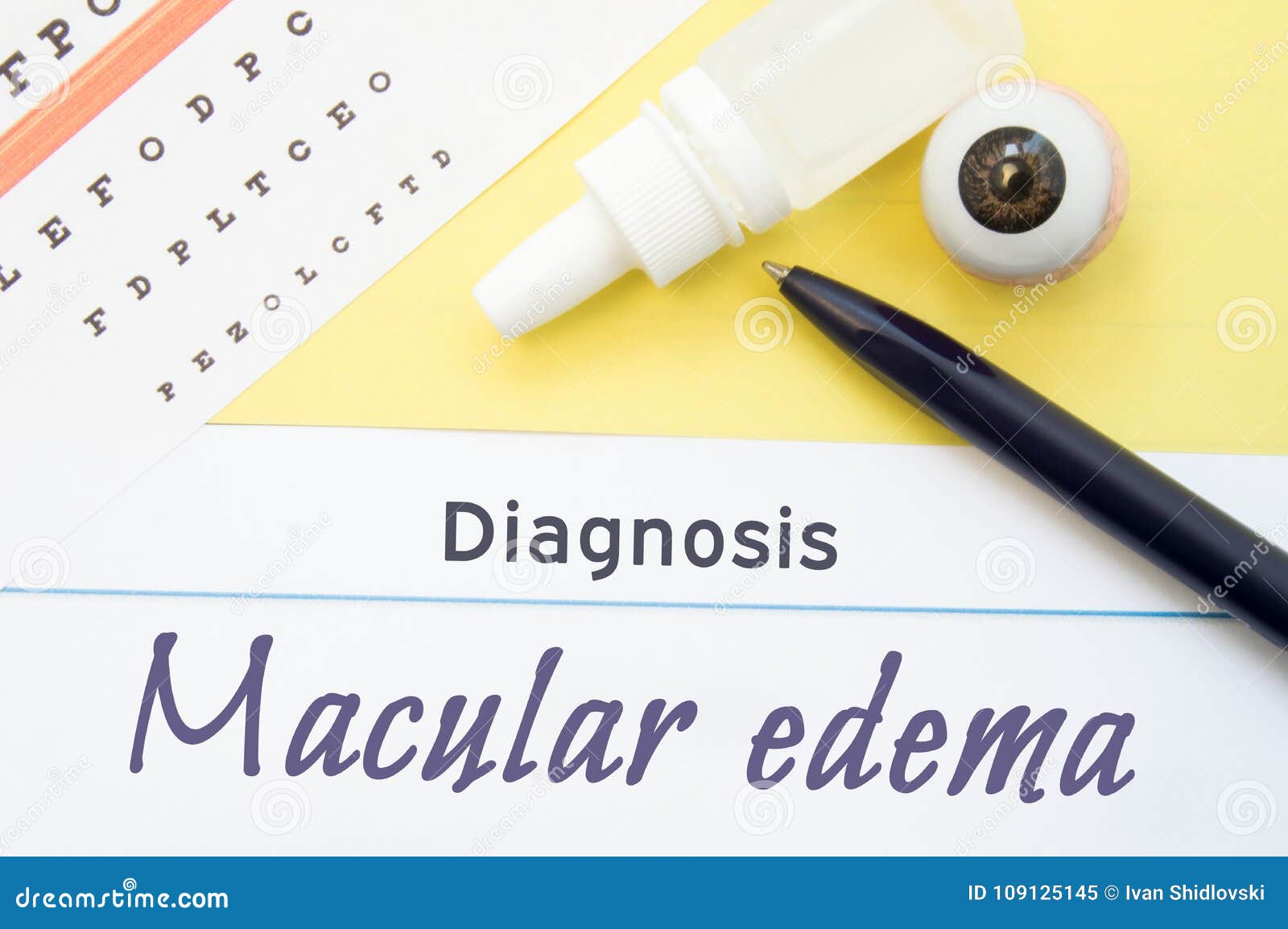 chart for testing visual acuity, eye drops and anatomical model lies next to inscription diagnosis macular edema. concept for diag