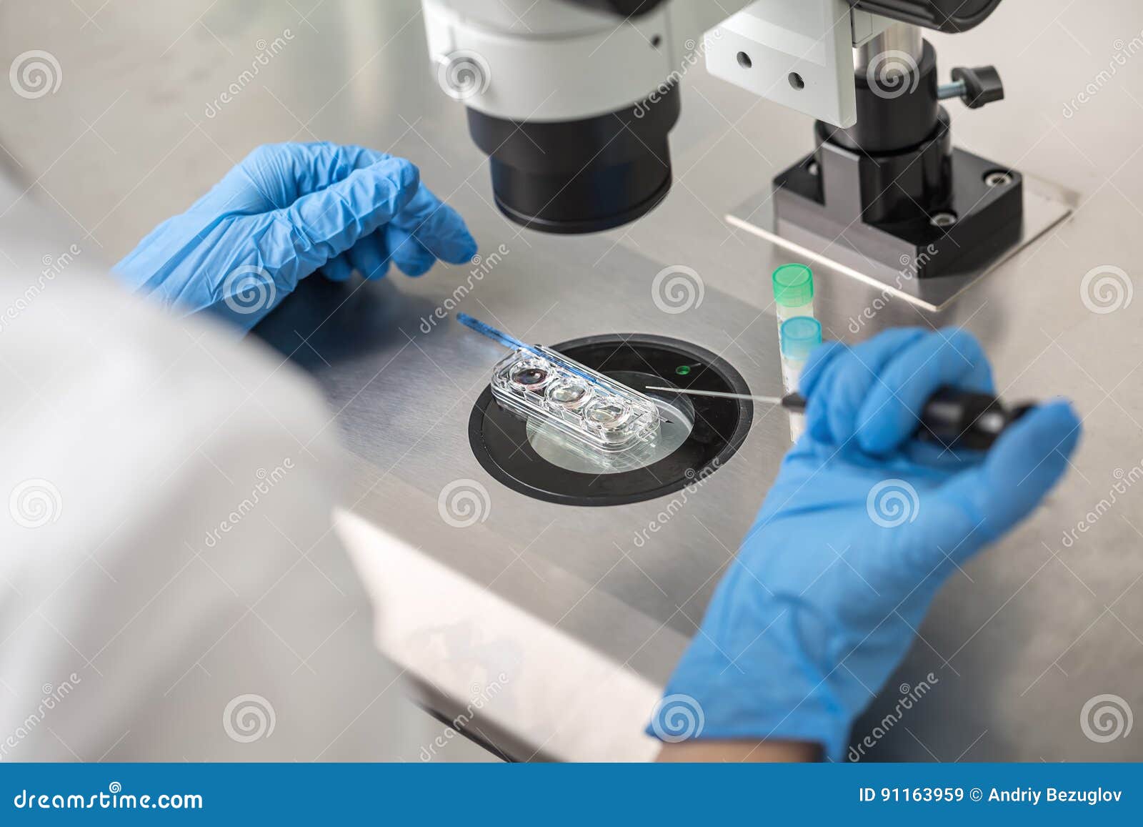 checking result of in vitro fertilization